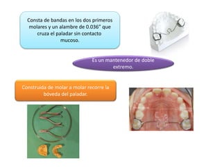 Consta de bandas en los dos primeros
molares y un alambre de 0.036” que
cruza el paladar sin contacto
mucoso.
Es un mantenedor de doble
extremo.
Construida de molar a molar recorre la
bóveda del paladar.
 