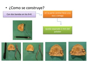 • ¿Como se construye?
Con dos bandas en los 6+6
en la parte central lleva una
asa u omega
queda separado 2 mm del
paladar
 