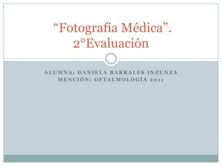 Alumna: Daniela Barrales Inzunza Mención: Oftalmología 2011  “Fotografía Médica”. 2°Evaluación 