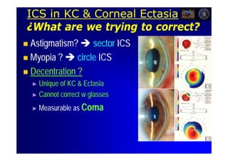 ICS in KC & Corneal Ectasia
¿What are we trying to correct?
 Astigmatism?  sector ICS
 Myopia ?  circle ICS

 Decentration ?
    ► Unique of KC & Ectasia
    ► Cannot correct w glasses

    ► Measurable   as Coma
 
