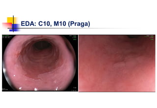 EDA: C10, M10 (Praga)