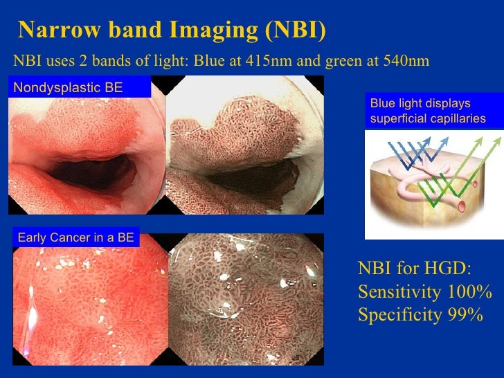 Barretts Brief Version For Upload