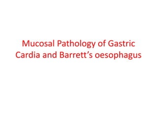 Mucosal Pathology of Gastric
Cardia and Barrett’s oesophagus
 