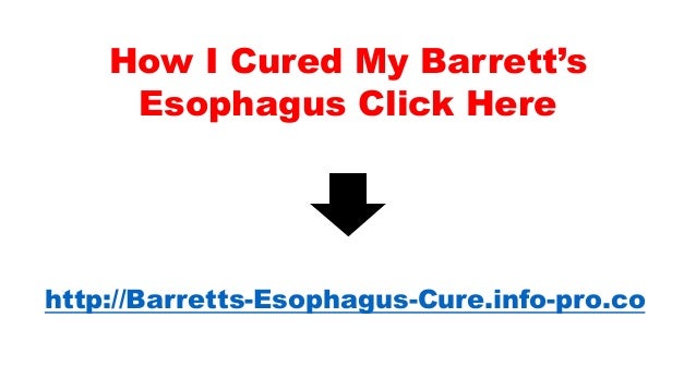 Barretts Esophagus, Barrett's Esophagus Hiatal Hernia, Barrett's