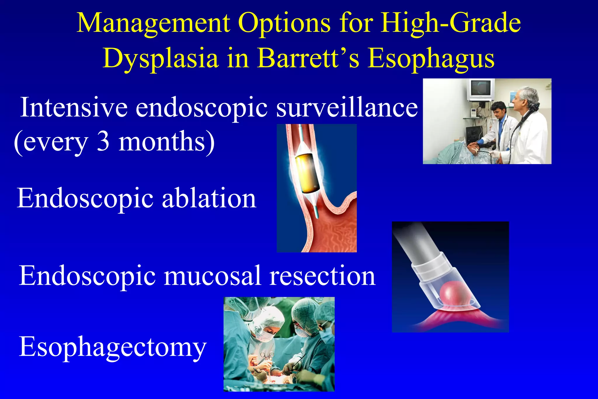 Barrett's esophagus; guidelines & new endoscopic techniques