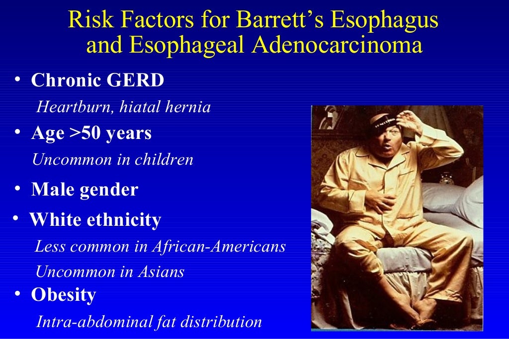Barrett's esophagus; guidelines & new endoscopic techniques