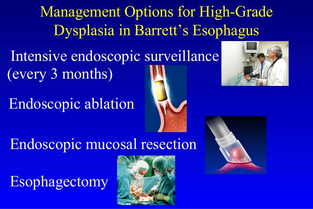 Barrett's esophagus; guidelines & new endoscopic techniques