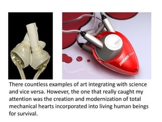 There countless examples of art integrating with science
and vice versa. However, the one that really caught my
attention was the creation and modernization of total
mechanical hearts incorporated into living human beings
for survival.
 
