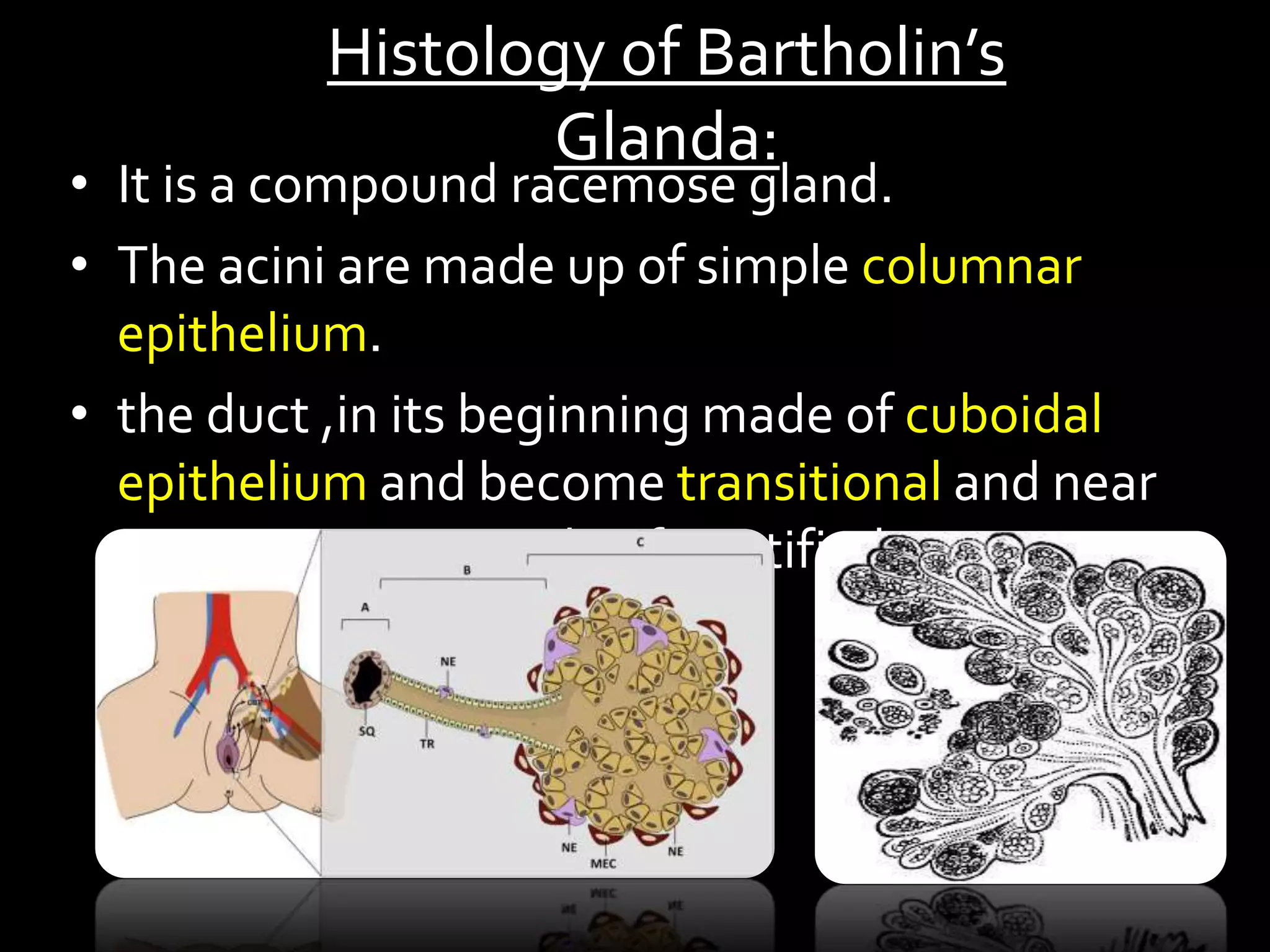 Bartholin Gland Cyst PPTX Bartholin Gland Cyst PPTX