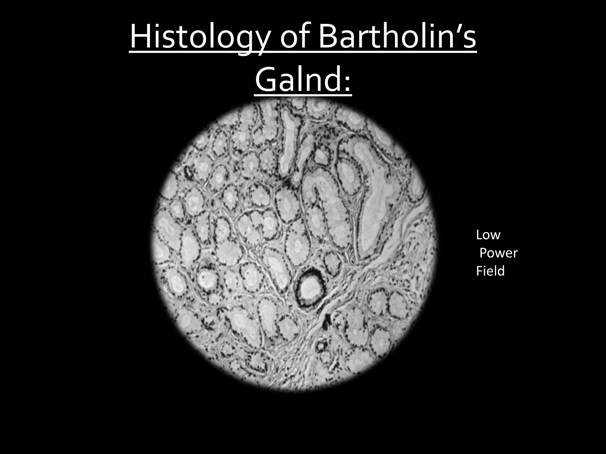 Bartholin gland cyst | PPT
