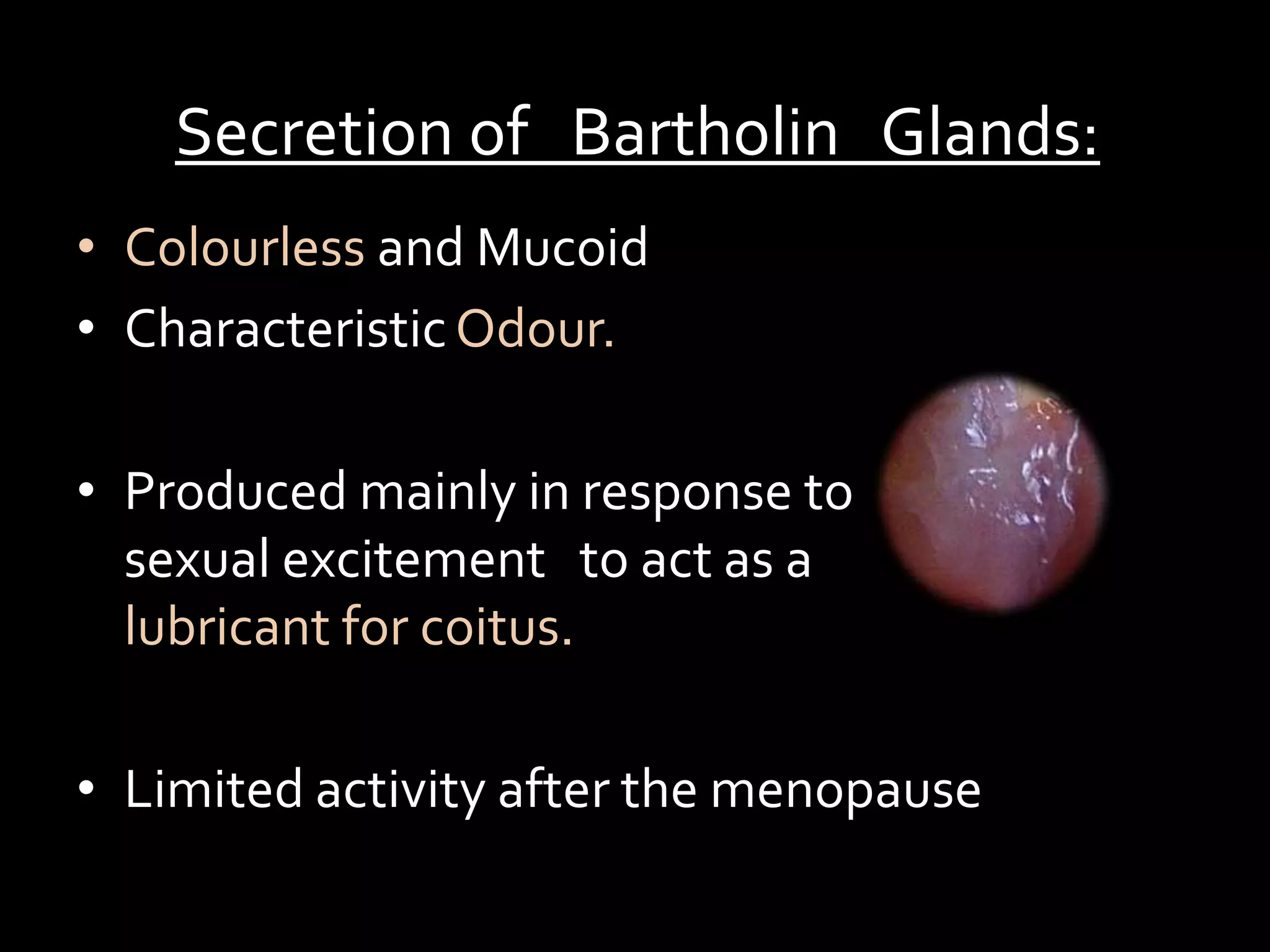 Bartholin gland cyst | PPT