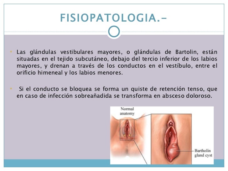 Tecnica debajo de la falda 10