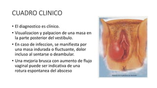 CUADRO CLINICO
• El diagnostico es clínico.
• Visualizacion y palpacion de una masa en
la parte posterior del vestibulo.
• En caso de infeccion, se manifiesta por
una masa indurada o fluctuante, dolor
incluso al sentarse o deambular.
• Una mejoria brusca con aumento de flujo
vaginal puede ser indicativa de una
rotura espontanea del absceso
 