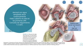 bartolinitis clase.pptx descripcion de la clase | PPTX