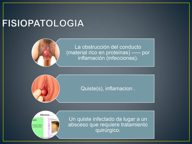 Bartholinits Bartolinitis, quistes y abscesos | PPTX