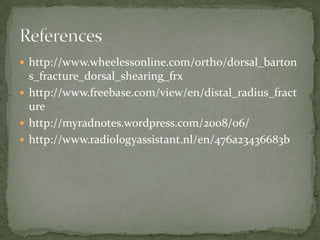  http://www.wheelessonline.com/ortho/dorsal_barton
  s_fracture_dorsal_shearing_frx
 http://www.freebase.com/view/en/distal_radius_fract
  ure
 http://myradnotes.wordpress.com/2008/06/
 http://www.radiologyassistant.nl/en/476a23436683b
 