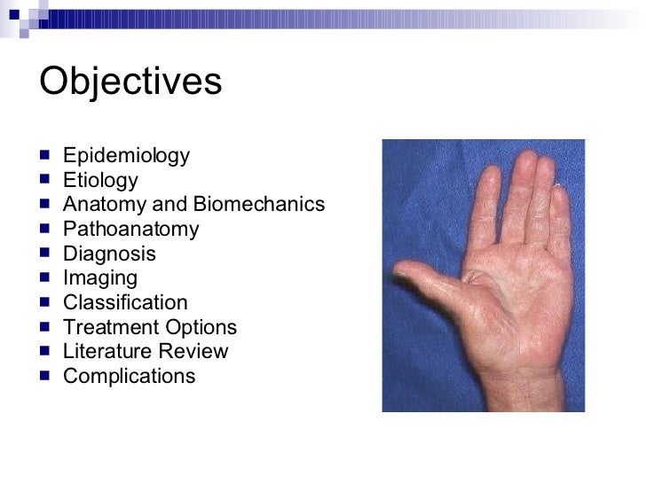 Basal Joint Arthritis Of The Thumb
