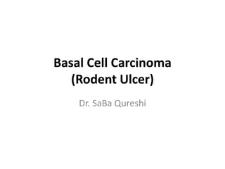 Basal Cell Carcinoma
(Rodent Ulcer)
Dr. SaBa Qureshi
 