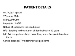 PATIENT DETAILSPATIENT DETAILS
Mr. Vijayaragavan
77 years / Male
MR/17/007209
Biopsy No.: 93/17
Nature of specimen: Excisi...