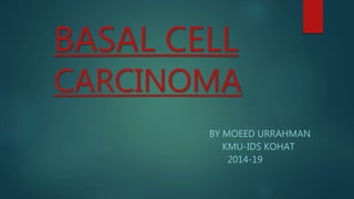 BASAL CELL
CARCINOMA
BY MOEED URRAHMAN
KMU-IDS KOHAT
2014-19
 