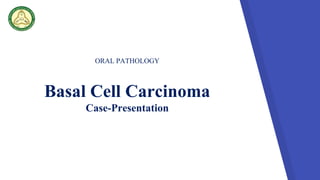 ORAL PATHOLOGY
Basal Cell Carcinoma
Case-Presentation
 