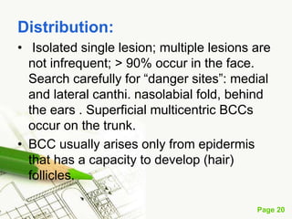 Basal cell carcinoma (BCC)