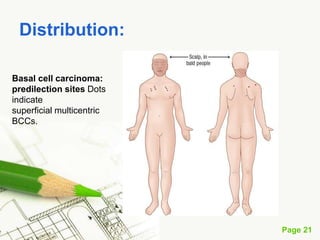 Basal cell carcinoma (BCC)