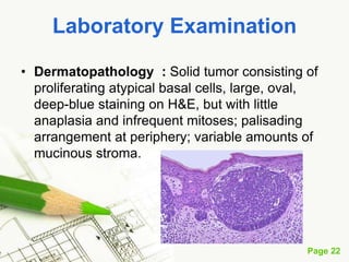 Basal cell carcinoma (BCC)