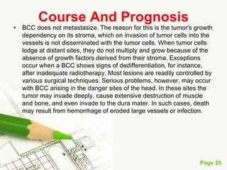 Basal cell carcinoma (BCC)