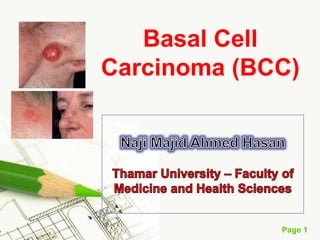 Page 1
Basal Cell
Carcinoma (BCC)
 