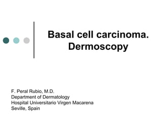 Basal cell carcinoma.
                   Dermoscopy



F. Peral Rubio, M.D.
Department of Dermatology
Hospital Universitario Virgen Macarena
Seville, Spain
 