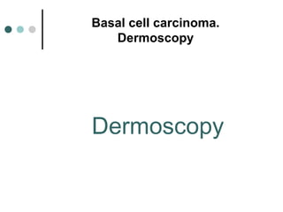 Basal cell carcinoma.
   Dermoscopy




Dermoscopy
 