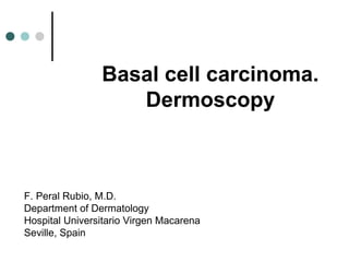 Basal cell carcinoma.
                   Dermoscopy



F. Peral Rubio, M.D.
Department of Dermatology
Hospital Universitario Virgen Macarena
Seville, Spain
 