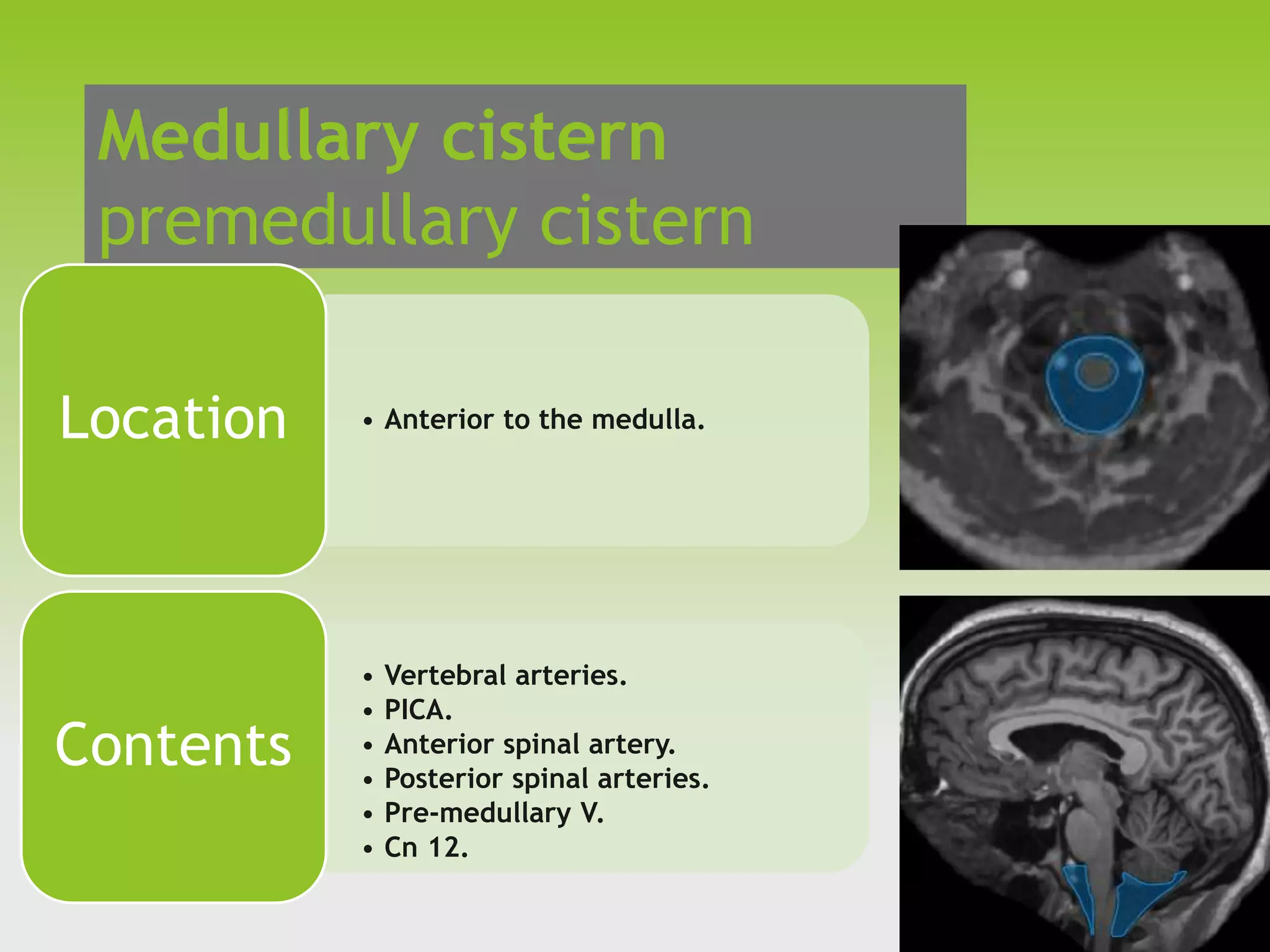 The Critical Role Of Patent Basal Cisterns - 0gxh1hs