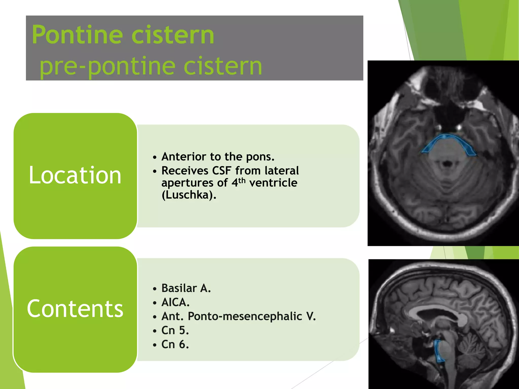 Patent Basal Cisterns:  New Research Reveals Surprising Implications - 5sib0d2