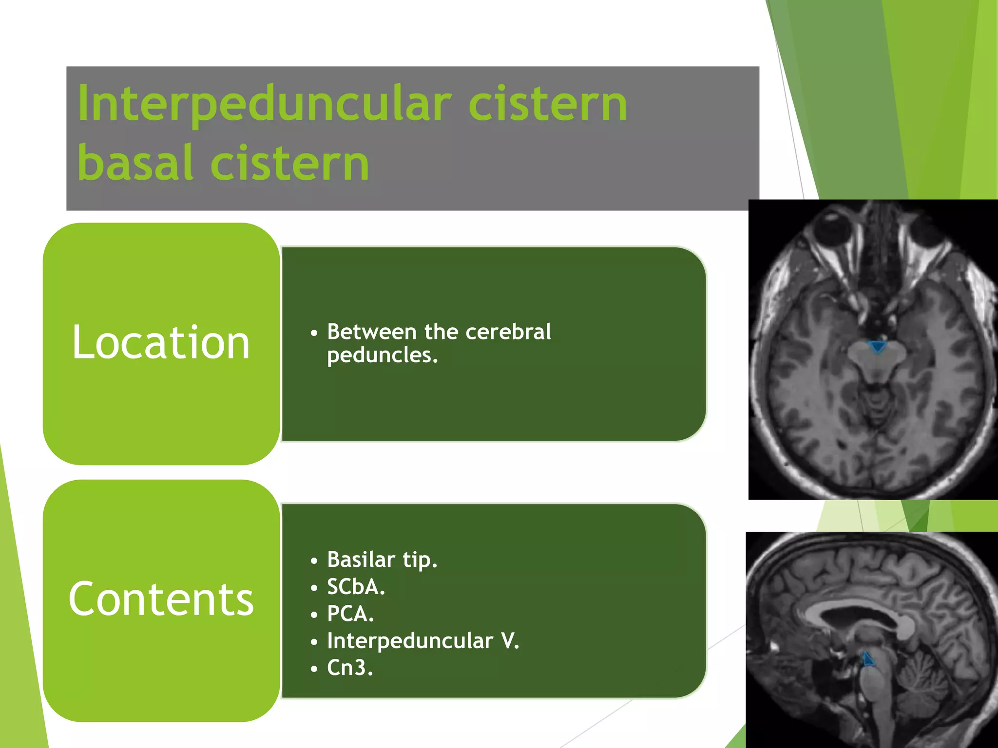 Urgent: Understanding Your Basal Cisterns' Patency - 4a6zxqd