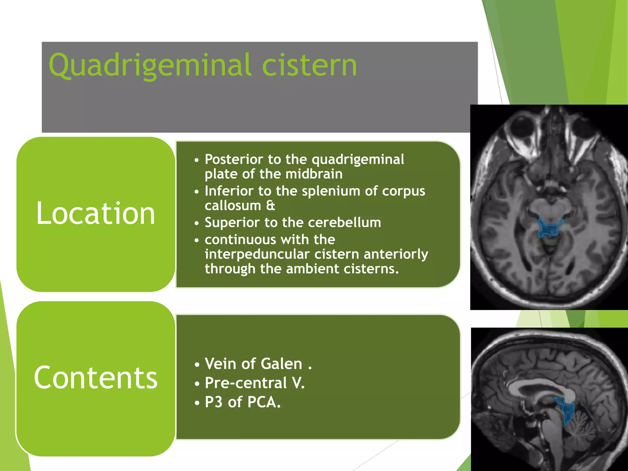 Urgent: Understanding Your Basal Cisterns' Patency - 0yvafsp