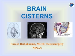 BRAIN
CISTERNS
Suresh Bishokarma, MCH ( Neurosurgery
NINAS
 