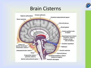 Cisterns of brain | PPT