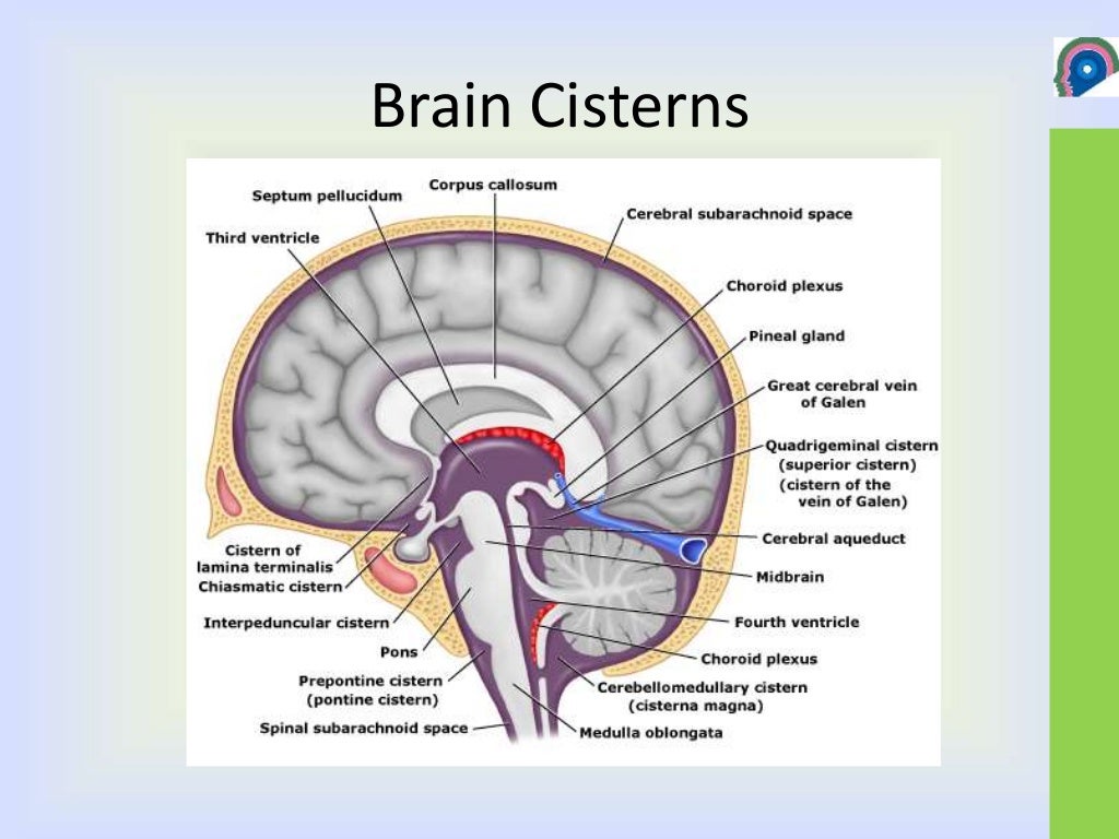 Cisterns of brain