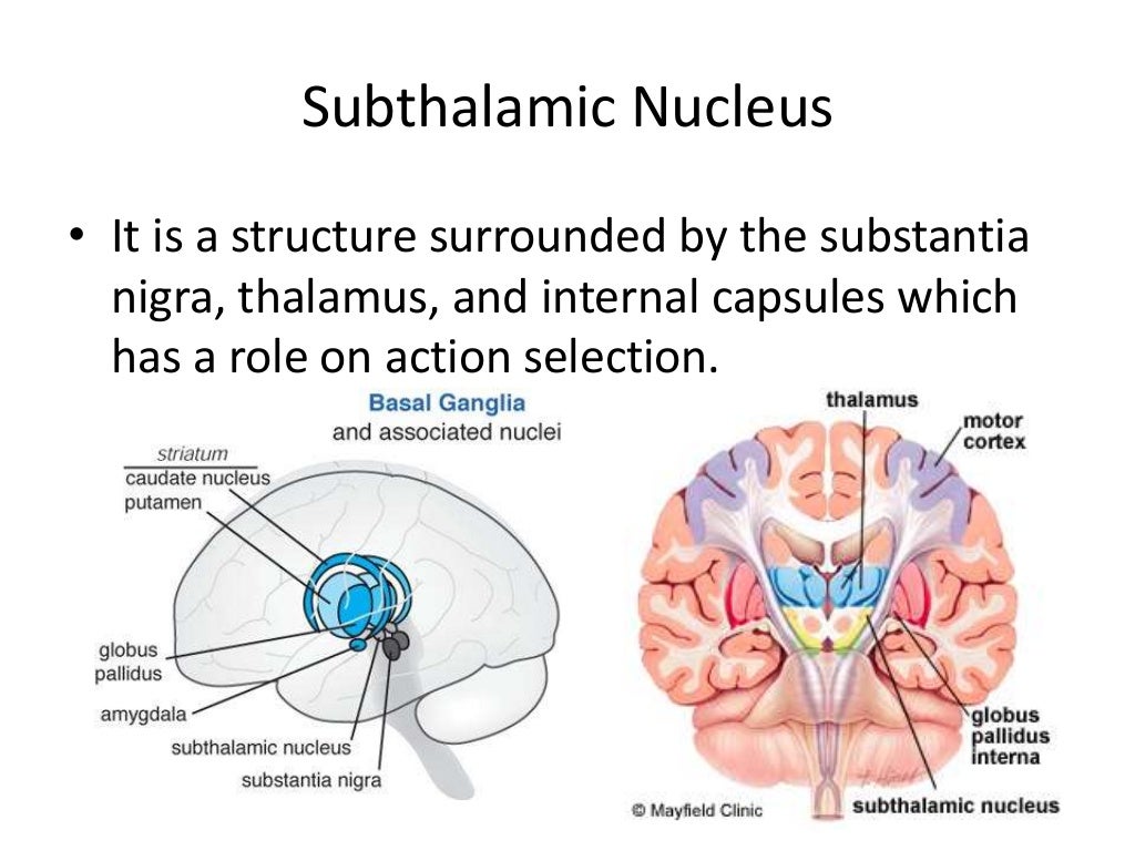 A Guide To Basal Ganglia Stroke vrogue.co