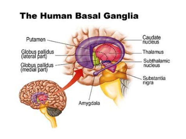 Basal Ganglia Stroke