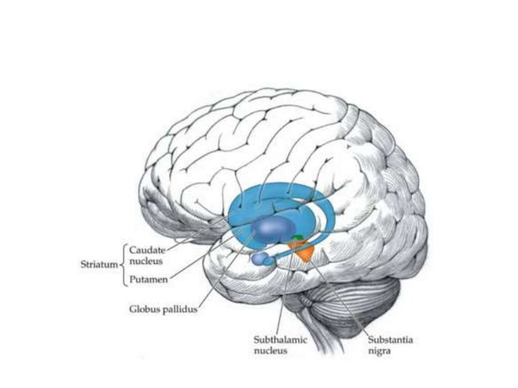 Basal ganglia stroke