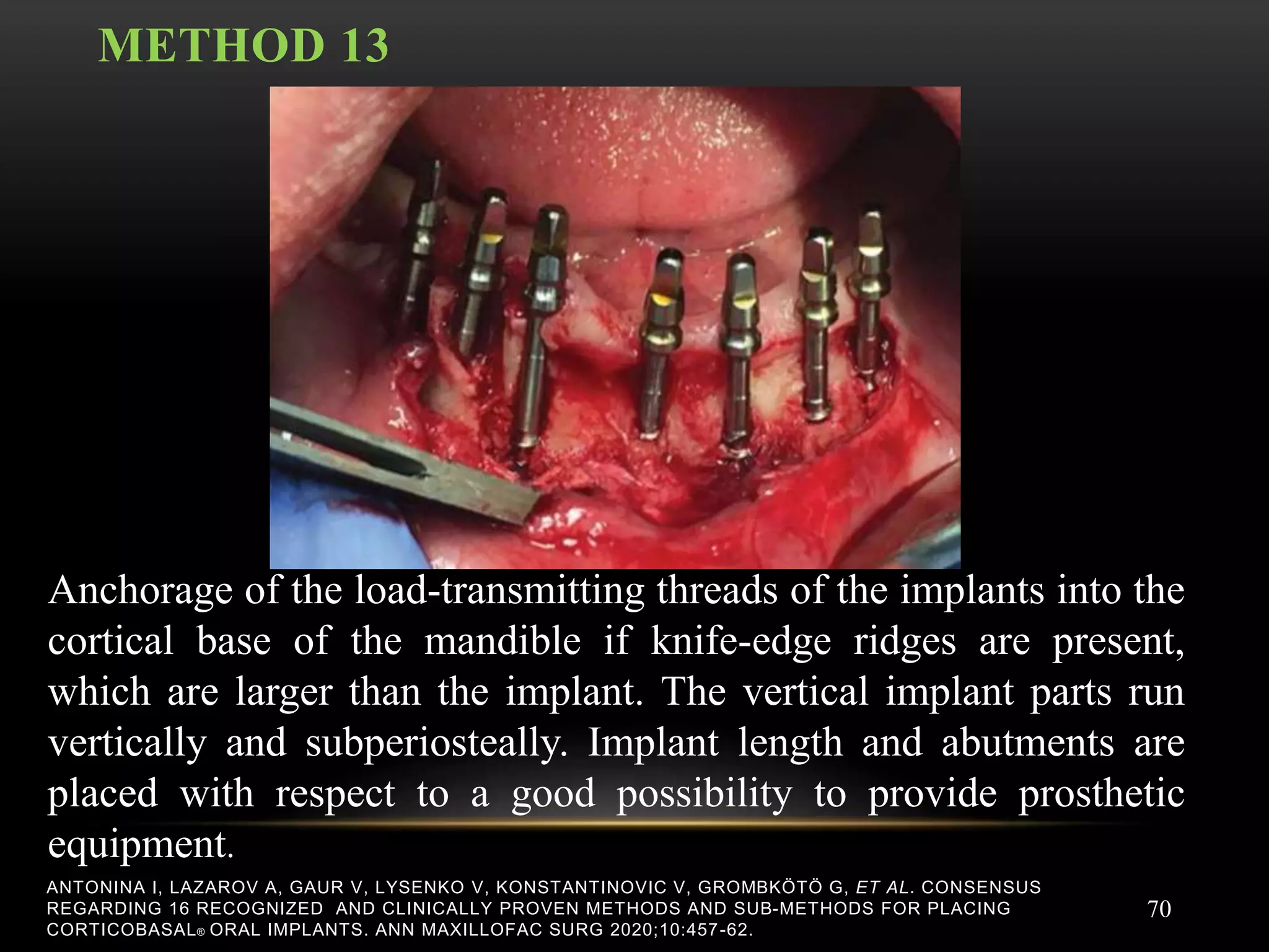 BASAL IMPLANTOLOGY gupta.pptx