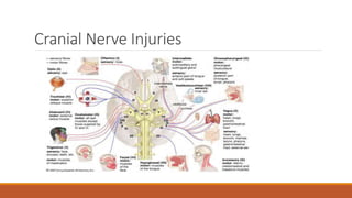 Cranial Nerve Injuries
 
