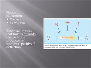  Standard
calibration
 25 mm/s
 0.1 mV/mm
 Electrical impulse
that travels towards
the electrode
produces an
upright (“positive”)
deflection
 