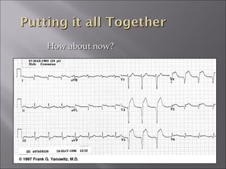 How about now?How about now?
 