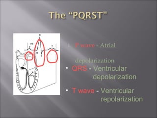  P wave - Atrial
depolarization
• T wave - Ventricular
repolarization
• QRS - Ventricular
depolarization
 