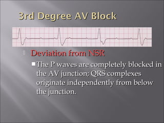  Deviation from NSRDeviation from NSR
The P waves are completely blocked inThe P waves are completely blocked in
the AV junction; QRS complexesthe AV junction; QRS complexes
originate independently from beloworiginate independently from below
the junction.the junction.
 