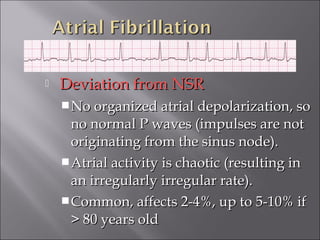  Deviation from NSRDeviation from NSR
No organized atrial depolarization, soNo organized atrial depolarization, so
no normal P waves (impulses are notno normal P waves (impulses are not
originating from the sinus node).originating from the sinus node).
Atrial activity is chaotic (resulting inAtrial activity is chaotic (resulting in
an irregularly irregular rate).an irregularly irregular rate).
Common, affects 2-4%, up to 5-10% ifCommon, affects 2-4%, up to 5-10% if
> 80 years old> 80 years old
 